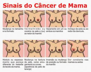 Sinais do Câncer de Mama