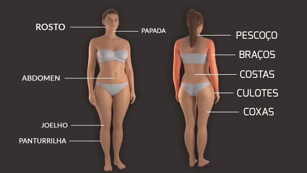 Regiões de aplicação