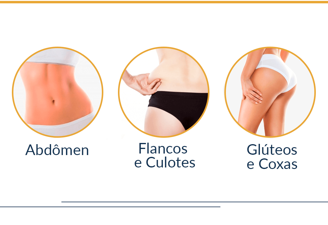 áreas do tratamento