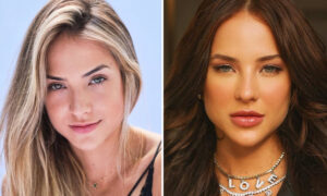 Harmonização Facial - Gabi Martins - Antes e Depois