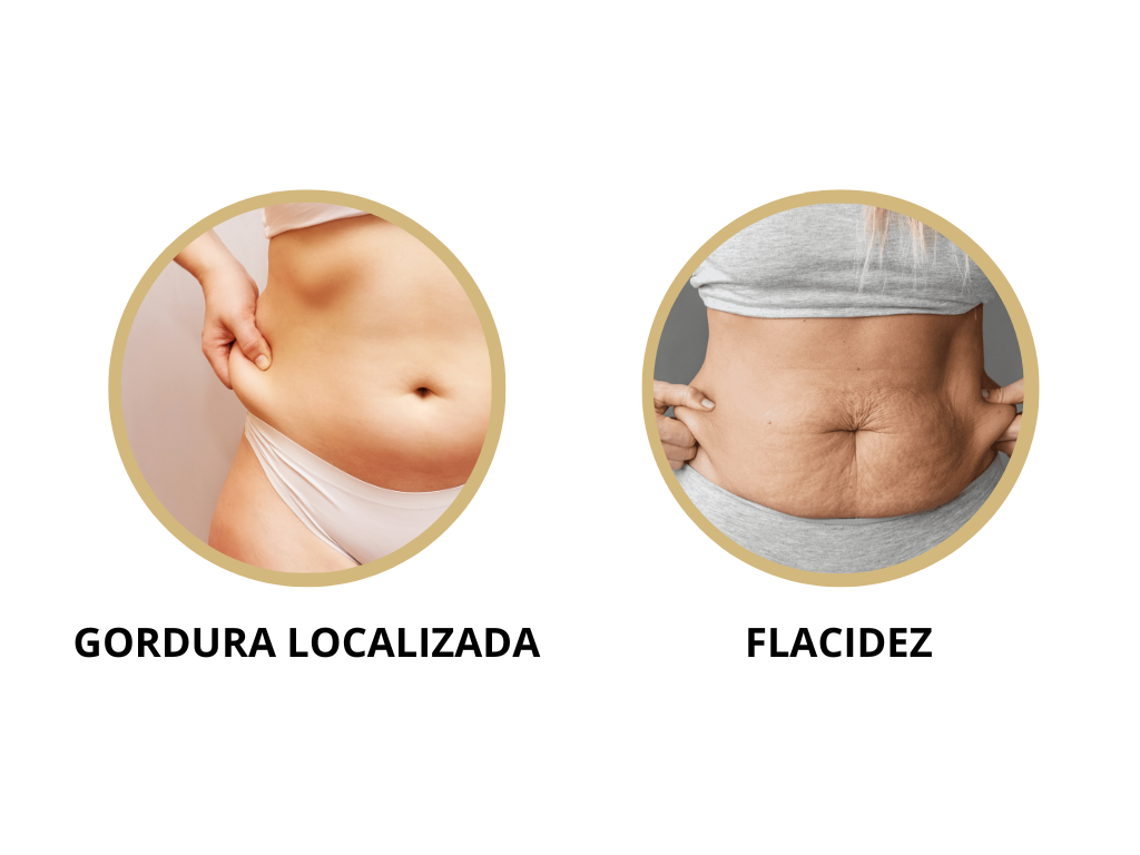 gordura localizada e flacidez