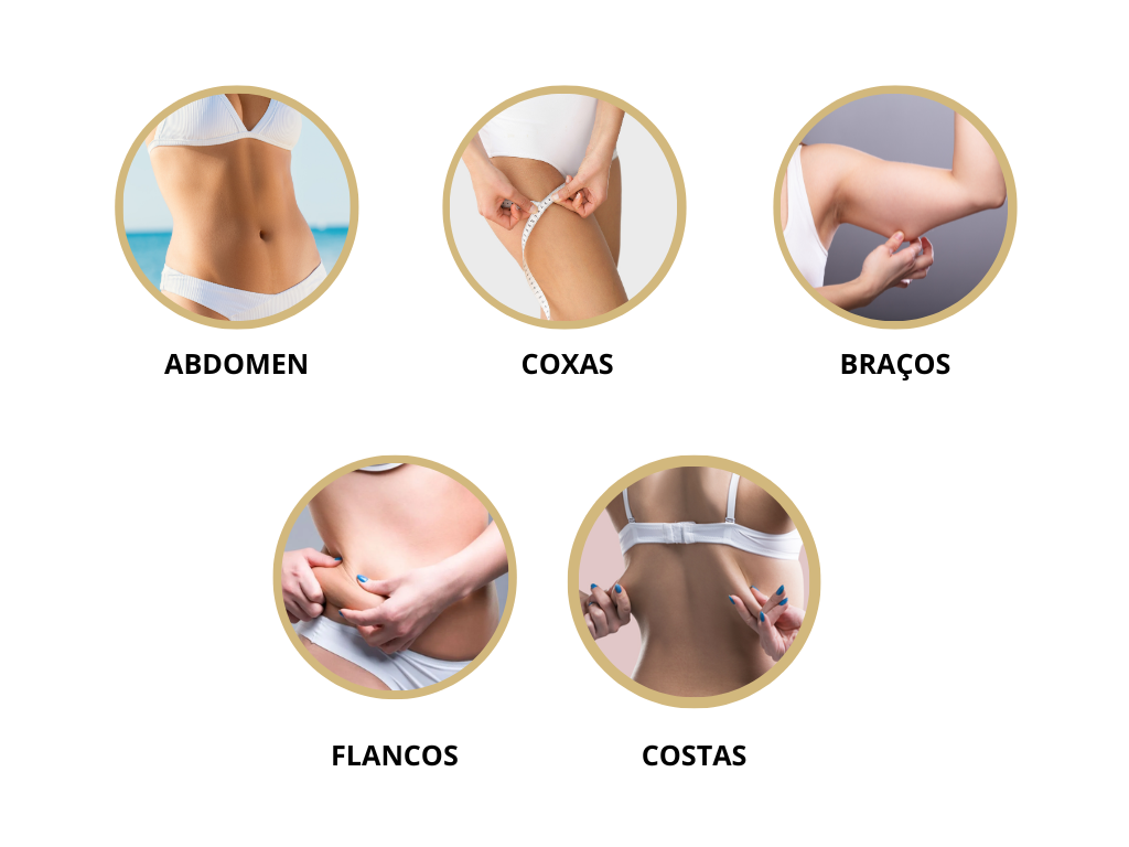 areas para fazer o lipotech