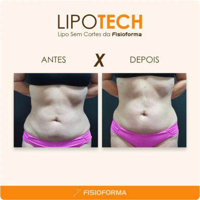 Lipo Tech 3